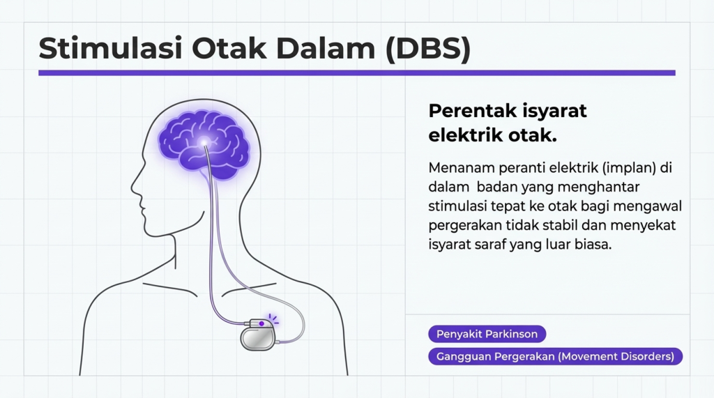 Stimulasi Otak Dalam (DBS)